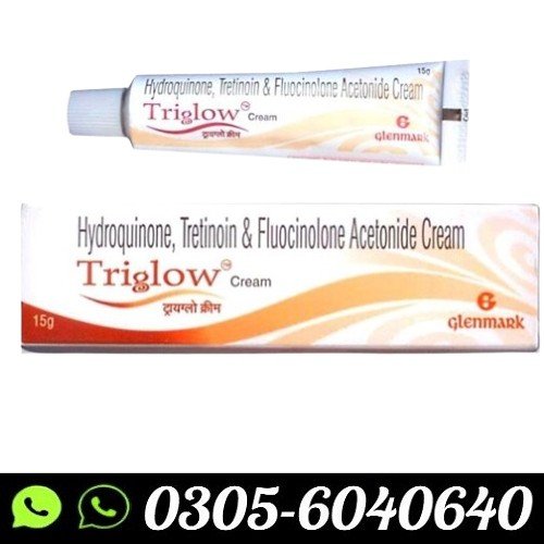 triglow-cream-20gm